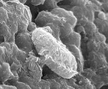 standby for nakhla bacteria photo