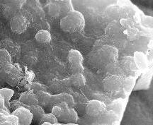 standby for nakhla bacteria photo