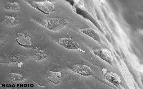 standby for nakhla bacteria photo