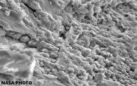 standby for nakhla bacteria photo